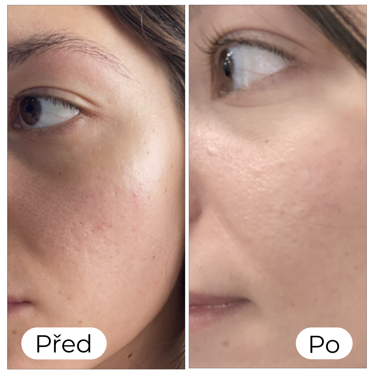 BB krém pro světlou pleť (MEDIUM) s SPF 20