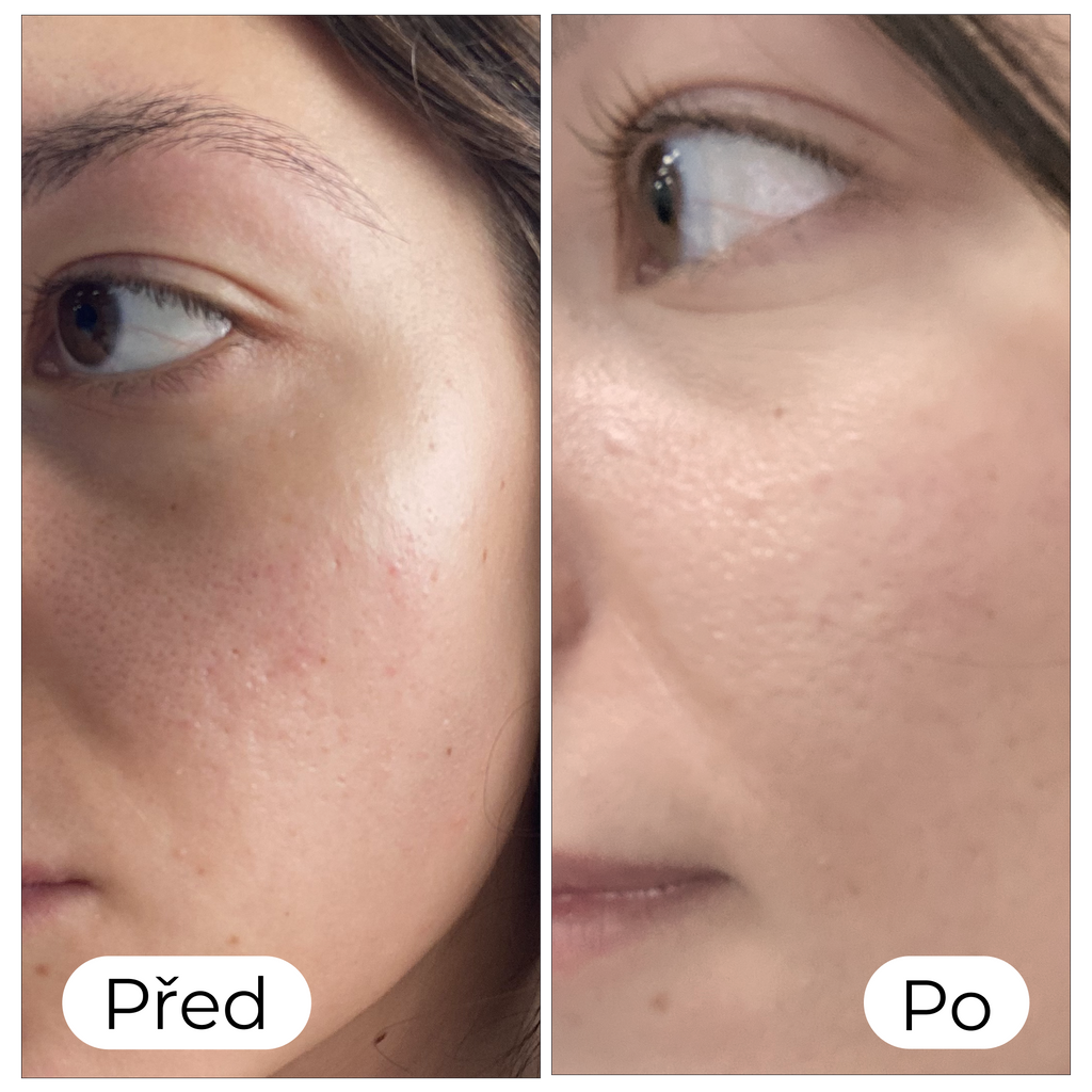 BB krém pro světlou pleť (MEDIUM) s SPF 20